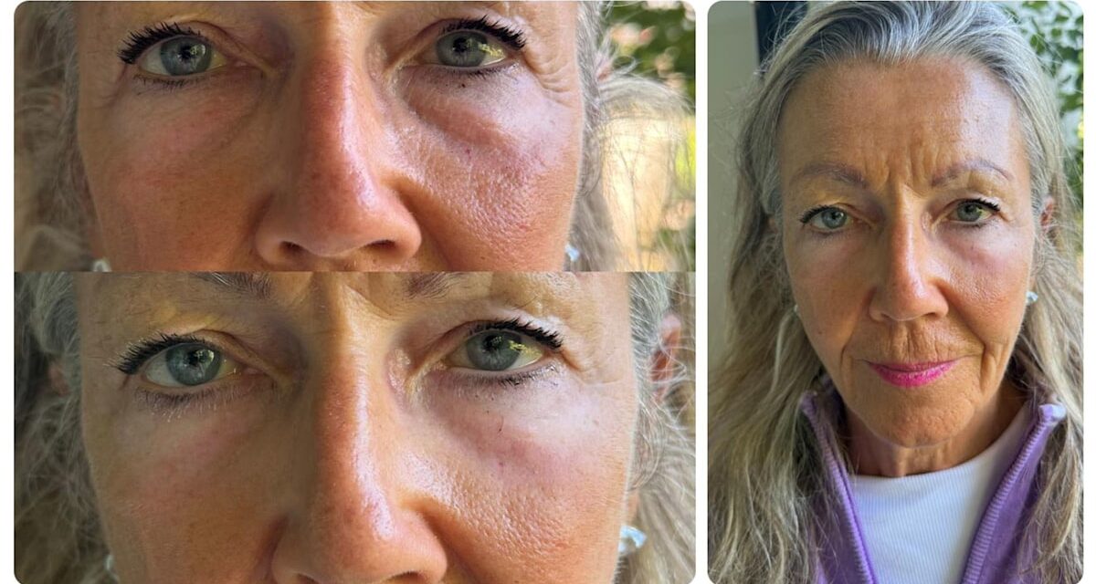 Ma belle-mère était sur le point de subir une chirurgie des paupières, puis ce nouveau gel pour les yeux de 15 £ a changé d&rsquo;avis