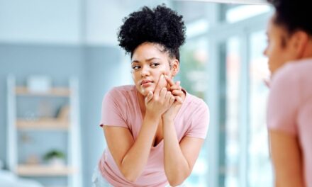 Le dermatologue partage les habitudes quotidiennes susceptibles d&rsquo;aggraver l&rsquo;acné adulte – et comment les casser pour une peau plus claire