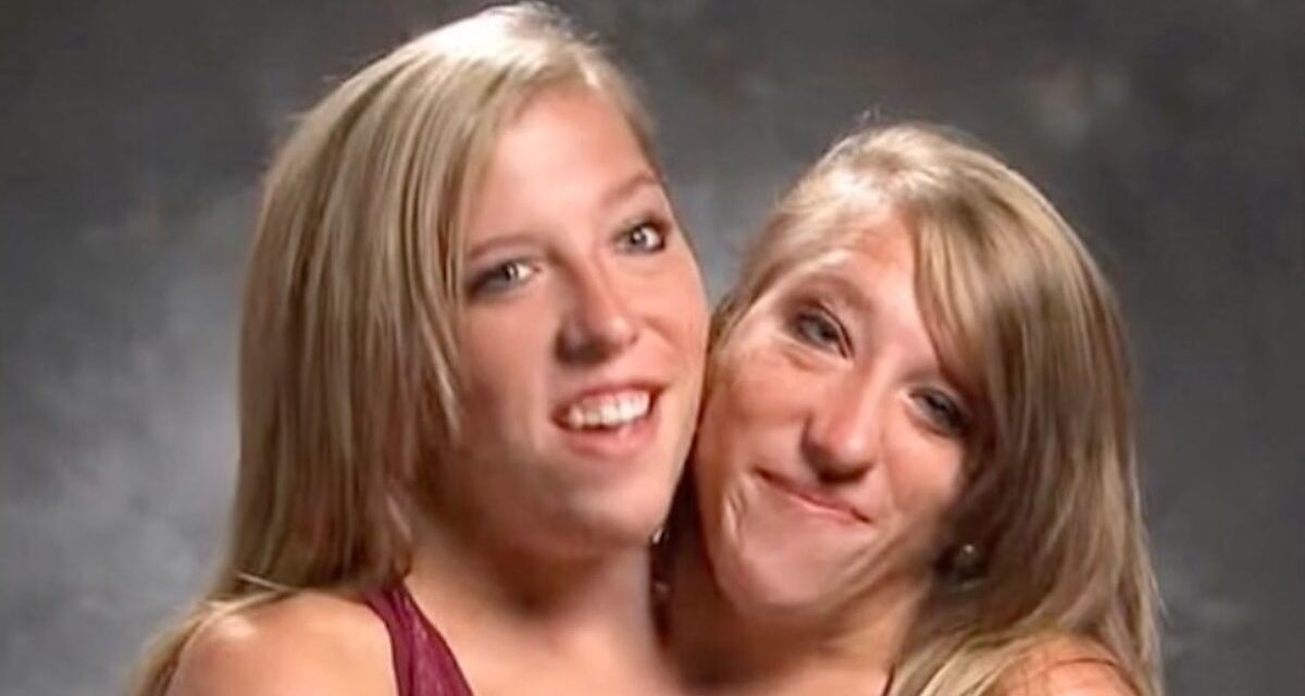 Twins conjoints Abby et Brittany Hensel Spark réaction avec des photos de mariage sans vue