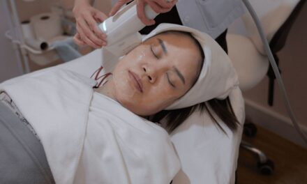 Ce traitement au laser « préventif » m&rsquo;a ramené à ma peau de 20 ans