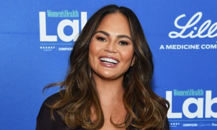 Chrissy Teigen dévoile une dent manquante après qu&rsquo;elle soit « tombée » lors d&rsquo;un match festif « qui a mal tourné »