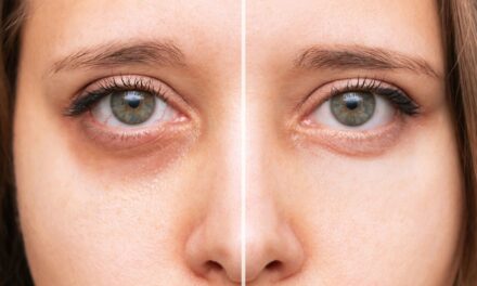 Pourquoi avez-vous vraiment des cernes : un expert vous explique les 4 types et comment les corriger