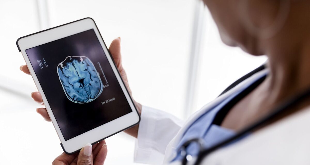 Aux prises avec le « cerveau de la ménopause » ? 4 façons simples de « reconstruire » la matière grise