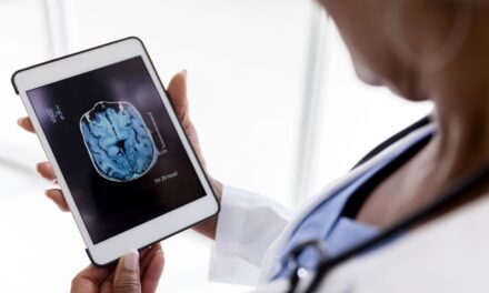 Aux prises avec le « cerveau de la ménopause » ? 4 façons simples de « reconstruire » la matière grise