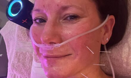 Visage de deuil : comment un traitement m&rsquo;a permis de me sentir et de paraître plus léger et plus lumineux